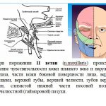 Иллюстрация №1: заболевания тройничного нерва (презентация) (Презентации - Медицина).