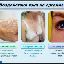 Иллюстрация №1: ФИЗИОЛОГИЧЕСКОЕ ВОЗДЕЙСТВИЕ ТОКА НА ОРГАНИЗМ ЧЕЛОВЕКА, СПОСОБЫ ОКАЗАНИЯ ПЕРВОЙ ПОМОЩИ ПОСТРАДАВШЕМУ ОТ ЭЛЕКТРИЧЕСКОГО ТОКА, ВОПРОСЫ ОРГАНИЗАЦИИ БЕЗОПАСНОЙ ЭКСПЛУАТАЦИИ ЭЛЕКТРОУСТАНОВОК (Презентации - Безопасность жизнедеятельности).