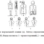 Иллюстрация №2: Осанка (Рефераты - Физическая культура).