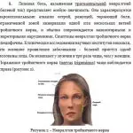 Иллюстрация №1: Заболевания тройничного нерва (Рефераты - Медицина).