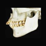 Иллюстрация №3: СОВРЕМЕННЫЕ МЕТОДЫ УСТРАНЕНИЯ ДИСКОЛОРИТОВ ЗУБОВ (Курсовые работы - Медицина).
